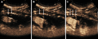 Fig. 3