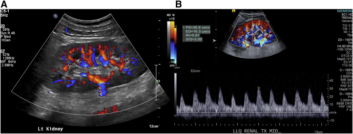 Figure 2