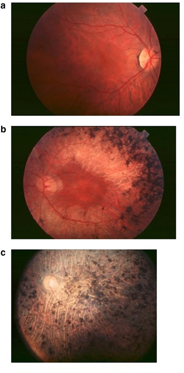 Fig. 1