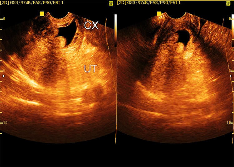 Fig. 2