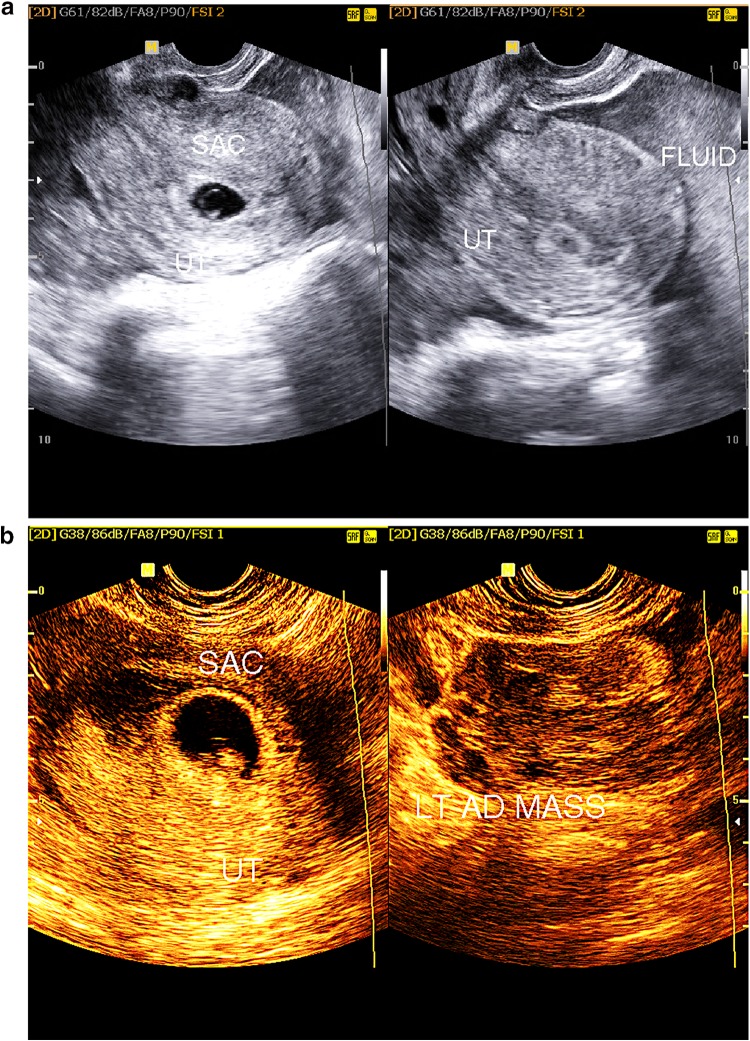 Fig. 1