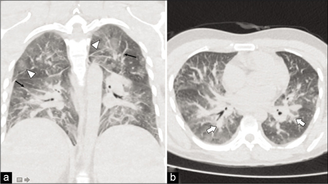 Figure 2: