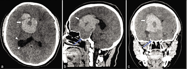 Figure 1: