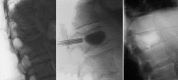 Fig. 6