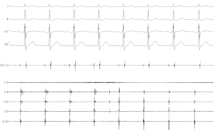 Fig. 3