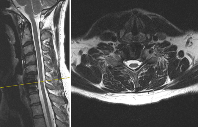 FIG. 3