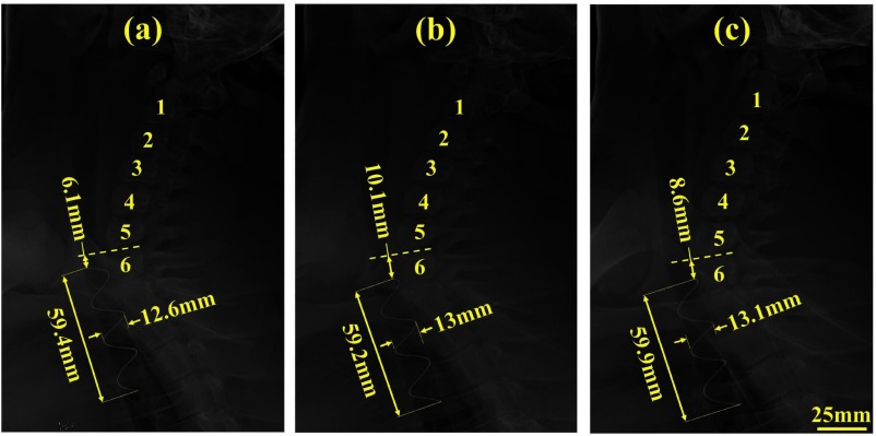 Fig. 14.