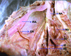 [Table/Fig-3]: