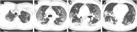 Fig. 2