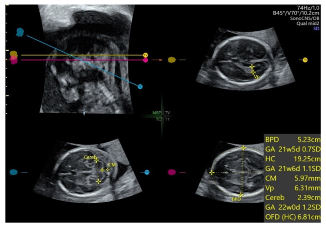 Figure 14