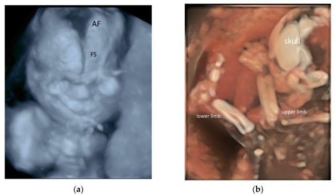 Figure 11