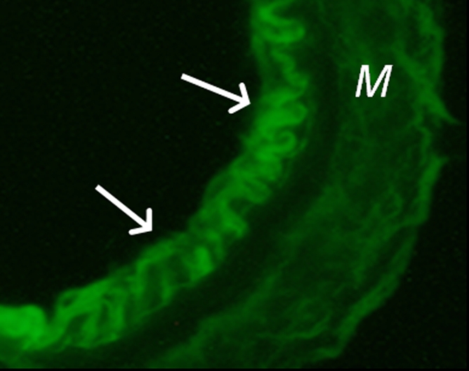 Figure 1f: