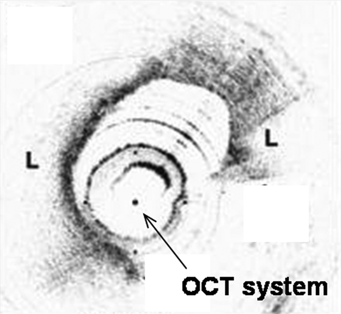 Figure 2d: