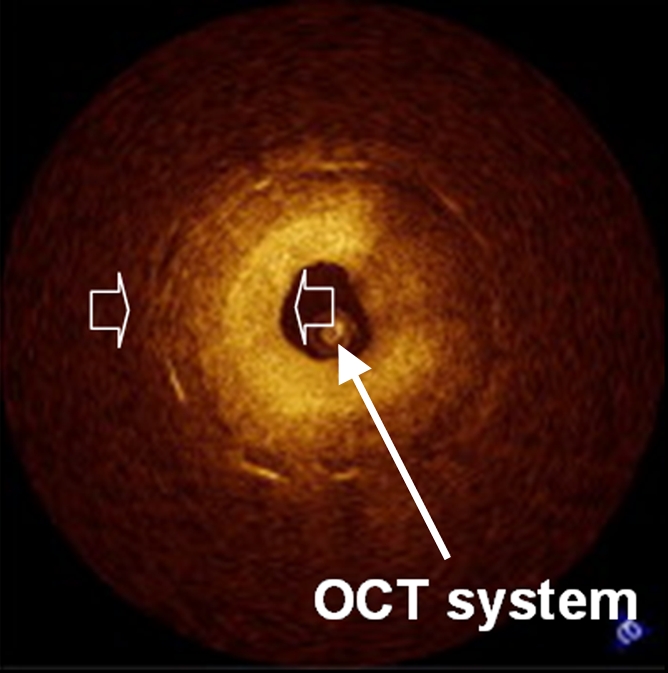 Figure 2b: