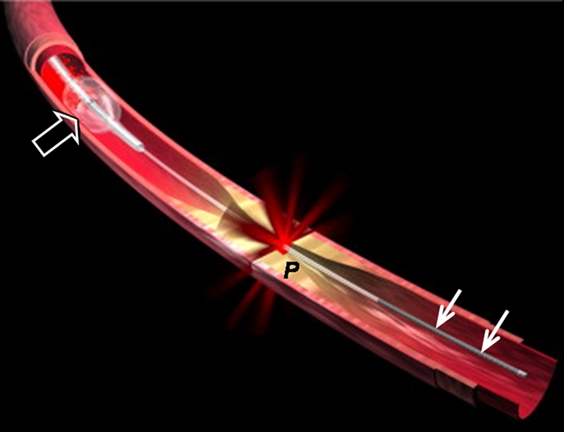 Figure 2a: