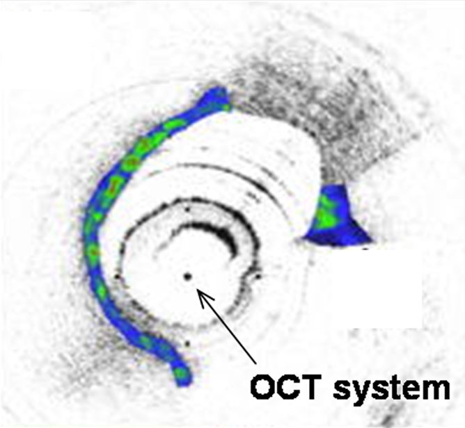 Figure 2e: