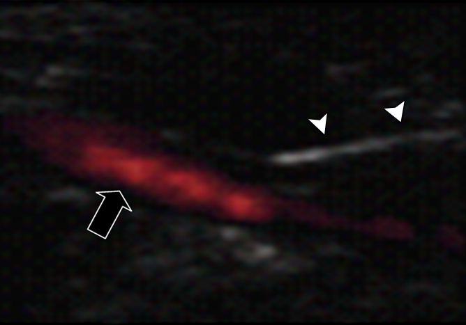 Figure 1b: