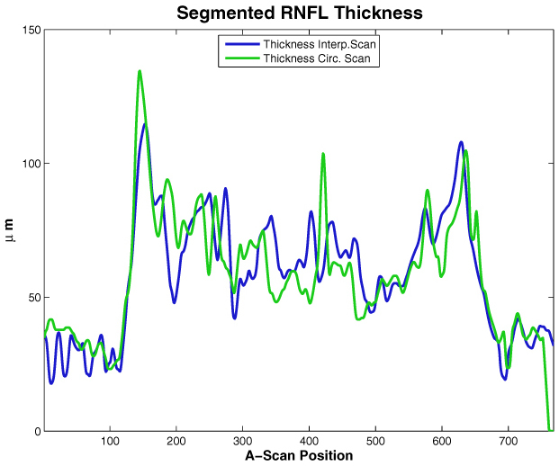 Fig. 12.