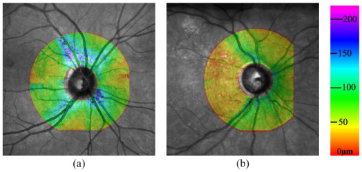 Fig. 13.