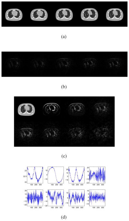 Fig. 14