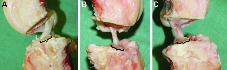 FIG. 2.