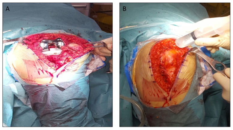 Figure 1 A, B