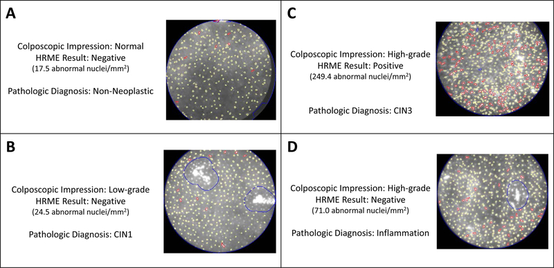 Figure 2: