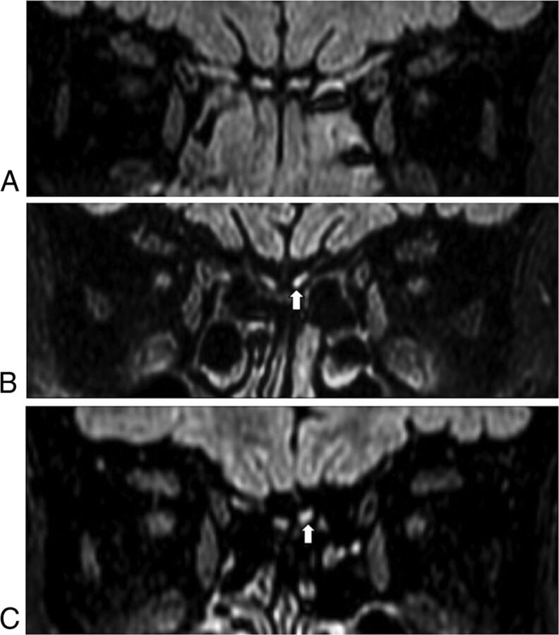 Fig 2.