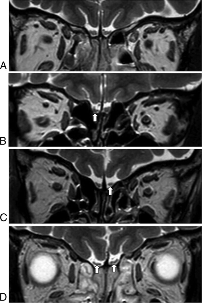 Fig 1.