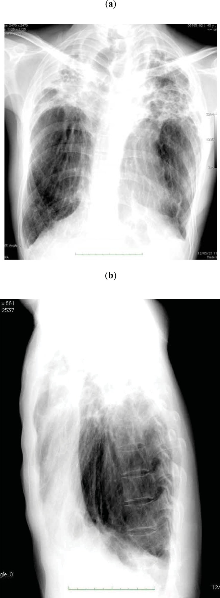 Fig. (1)