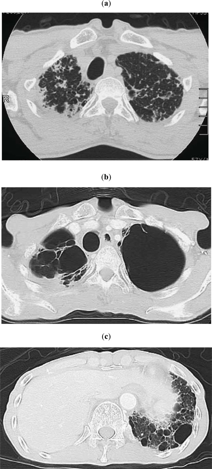 Fig. (4)