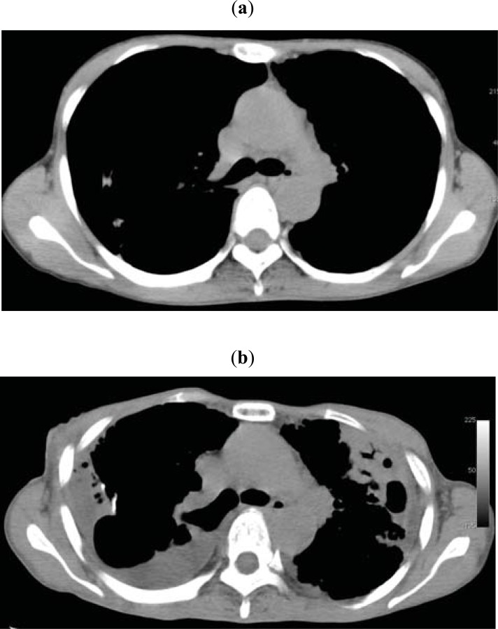 Fig. (2)