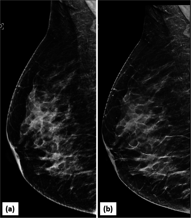 Fig. 12