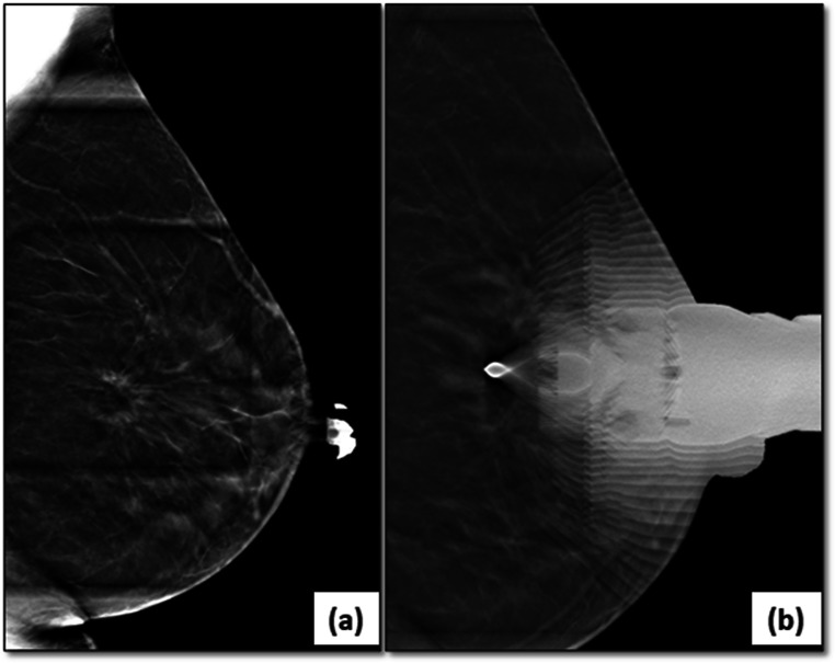 Fig. 13