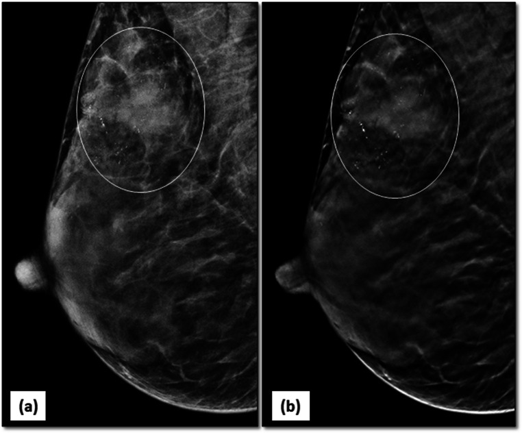 Fig. 11