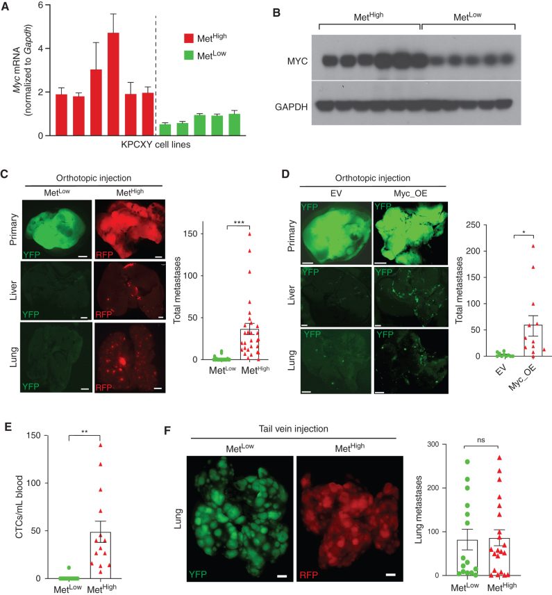 Figure 4. MYC regulates metastasis by enhancing tumor cell intravasation. A, Bar graph showing Myc mRNA levels in cell lines derived from MetHigh and MetLow tumors, normalized to Gapdh (n = 6 MetHigh and n = 5 MetLow cell lines). B, Western blot showing corresponding MYC protein levels in cell lines derived from MetHigh and MetLow tumors shown in A. C, Representative fluorescent images of primary tumors and associated liver and lung metastases following orthotopic transplantation of the cell lines in A and B into NOD.SCID mice. The bar graph shows the total number of metastases (liver and lung) counted following orthotopic transplantation of five MetLow cell lines or five MetHigh cell lines (pooled data from n = 49 mice in total). D, Representative fluorescent images of primary tumors, liver metastases, and lung metastases following orthotopic transplantation of MetLow cell lines that were stably transduced with either a Myc_OE or an empty vector (EV) construct. The bar graph shows the total number of metastases (liver and lung) counted following orthotopic transplantations of Myc_OE or EV cells. Data were pooled from four independent MetLow lines transduced with either the Myc_OE or EV construct transplanted into 12 NOD.SCID (for the Myc_OE cells) or 10 NOD.SCID mice (for the EV cells). E, Quantification of CTCs in arterial blood derived from the orthotopic tumors depicted in C (n = 27 mice examined) and D (n = 12 mice examined). F, Representative fluorescent images of lung metastases following tail vein injection of cell lines derived from the MetLow and MetHigh primary tumor clones. The bar graph shows the total number of lung metastases counted following tail vein injection of five MetLow cell lines or five MetHigh cell lines (pooled data from n = 36 mice in total). Statistical analysis by Student unpaired t test with significance indicated (*, P = 0.0152; **, P = 0.013; ***, P = 0.0008; ns, not significant). Error bars indicate SEM (C–F). Scale bar, 1 mm (C, D, and F).