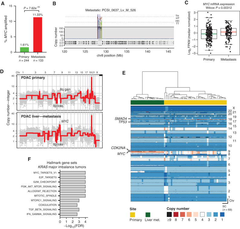 Figure 7. MYC amplification and enhanced transcriptional activity are associated with metastasis in human PDAC. A, Bar graph showing the relative frequencies of MYC amplifications in primary PDAC tumors and metastases from the COMPASS cohort. B, Representative plot of chromosome 8 from a metastatic tumor with MYC amplification. Orientation of breakpoint junctions from intrachromosomal rearrangements indicated by TH, HT, HH, and TT, where T = tail (3′ end of fragment) and H = head (5′ end of fragment). C, Box-and-whisker plot showing MYC mRNA levels (fragments per kilobase of exon per million, FPKM) in primary PDAC tumors and metastases. D, Representative genome-wide absolute copy-number plots of single cells retrieved from a primary (top) and its matched metastasis (bottom) illustrating acquisition of focal MYC amplification in the metastatic lesion. E, Heat-map depiction of cancer single cells (SC) sequenced from a matched primary PDAC and its liver metastasis. Color codes indicate absolute copy number in single cells. Top bar plot depicts tissue site from where single cells were retrieved. F, GSEA of tumors with a major imbalance of mutant KRAS (compared with those with no major imbalance) in the COMPASS cohort. Box-and-whisker plot in C indicates mean and interquartile range.