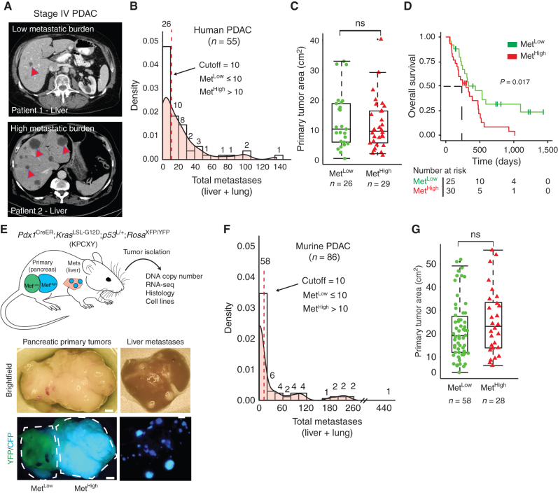 Figure 1. Advanced pancreatic tumors exhibit intertumoral differences in their propensity for metastasis. A, CT imaging of human PDAC liver metastasis demonstrating heterogeneity in metastatic burden in stage IV disease. Arrowheads indicate solitary metastasis in the top image and selected metastases in the bottom. B, Density plot and histogram showing the distribution of total (liver and lung) metastases enumerated from CT scans of human stage IV PDAC at the time of diagnosis (n = 55). Values above each histogram bar represent the number of patients in each group. The vertical dotted line (red) represents the cutoff between MetLow tumors [≤10 metastases (mets)] and MetHigh tumors (>10 mets) determined by k-means clustering. C, Quantification of tumor area (based on tumor dimensions from largest cross-sectional plane on imaging) comparing MetLow and MetHigh cases from the cohort in B. D, Overall survival analysis of the cohort in B. E, Top, schematic view of the KPCXY model, showing multiple primary tumors distinguishable by color arising in the pancreas with matched metastases in the liver. Bottom, representative fluorescent stereomicroscopic images showing a YFP+ tumor adjoining a CFP+ tumor in the pancreas (left) and liver metastases derived from the CFP+ tumor in the same animal (right). F, Density plot and histogram showing the distribution of total (liver and lung) metastases enumerated at autopsy of KPCXY mice. Values above each histogram bar represent the number of tumors giving rise to the indicated number of metastases, based on color (n = 85 tumors from 30 KPCXY mice). The vertical dotted line (red) represents the cutoff between MetLow tumors (≤10 mets, n = 58) and MetHigh tumors (>10 mets, n = 28) determined by k-means clustering. G, Quantification of tumor area comparing MetLow and MetHigh tumors from the cohort in F. Statistical analysis by Student unpaired t test with P values indicated (ns, not significant). Box-and-whisker plots in C and G indicate mean and interquartile range. Scale bar for E, 1 mm.