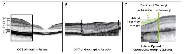 Fig 3