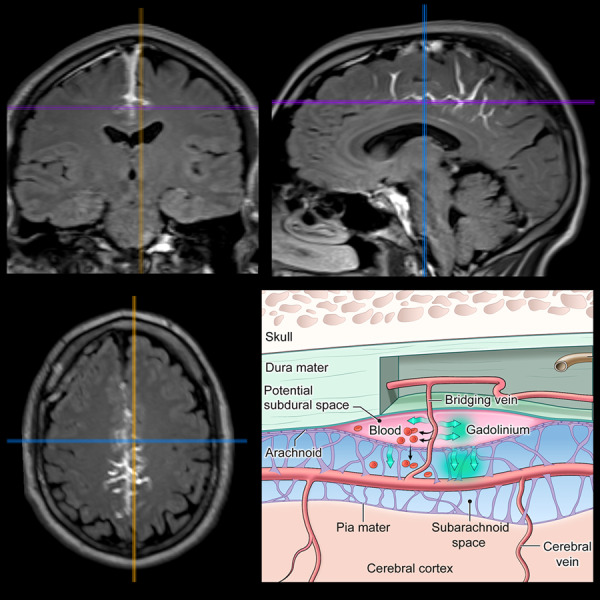 Graphical Abstract