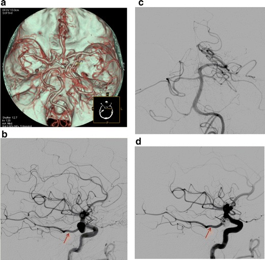 Fig. 12