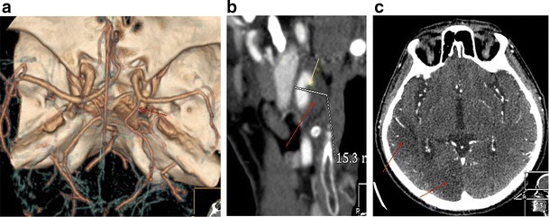 Fig. 13