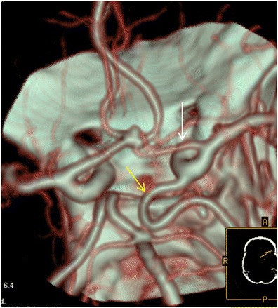 Fig. 6