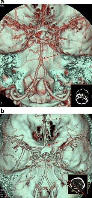 Fig. 10