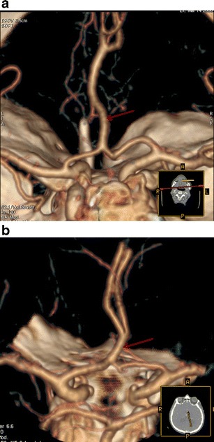 Fig. 8