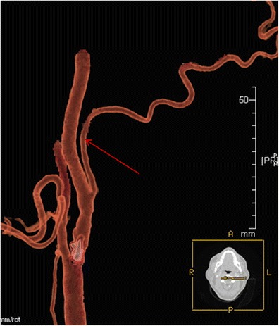 Fig. 5