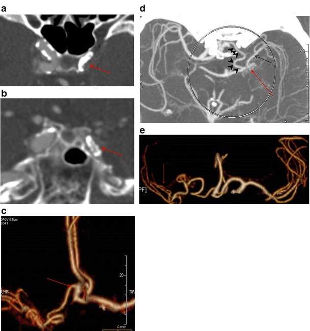 Fig. 11