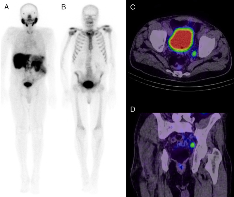 FIGURE 3