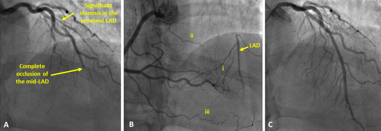 Fig. (1)