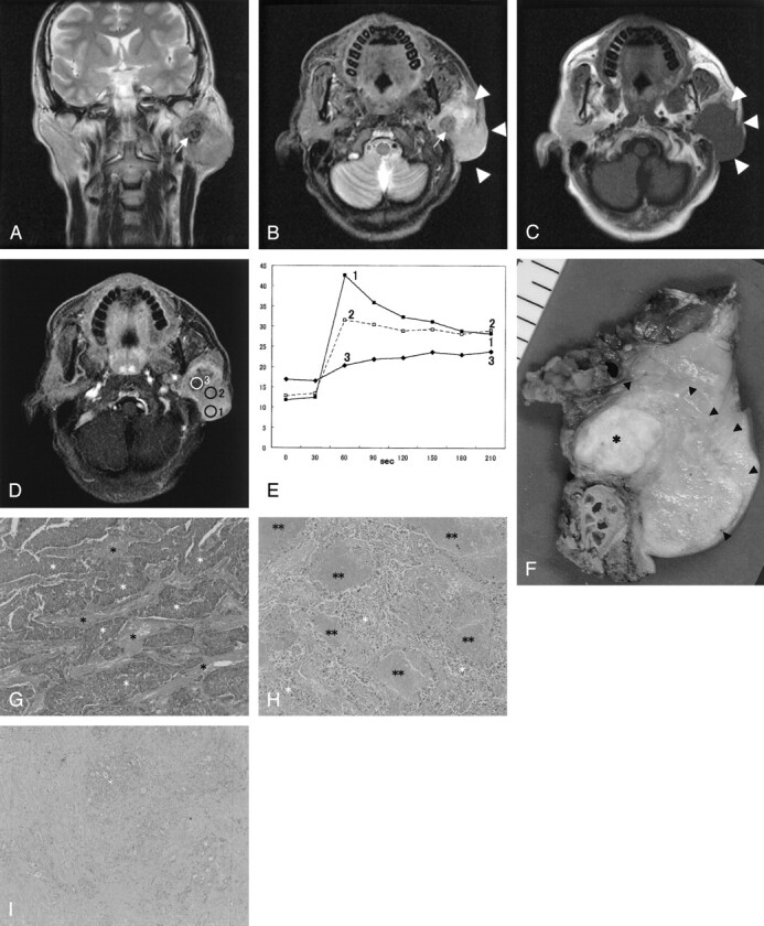 Fig 1.